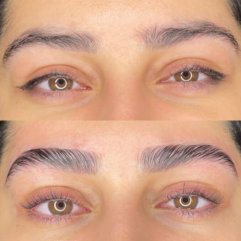 Perfekte Augenbrauen mit Augenbrauenlaminierung & Brow Botox: Warum es sich für dich lohnt!
