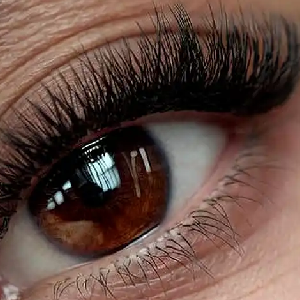 Wimpernkranzverdichtung